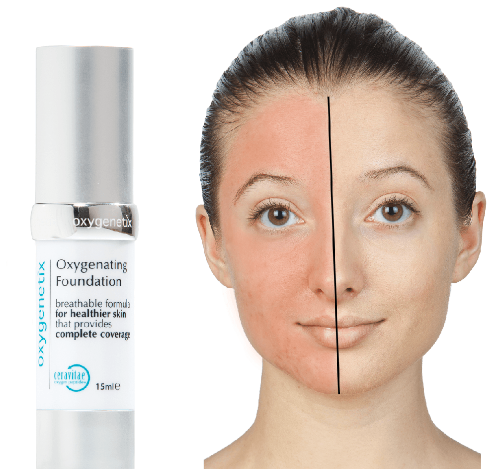 oxygenetix foundation before and after 1