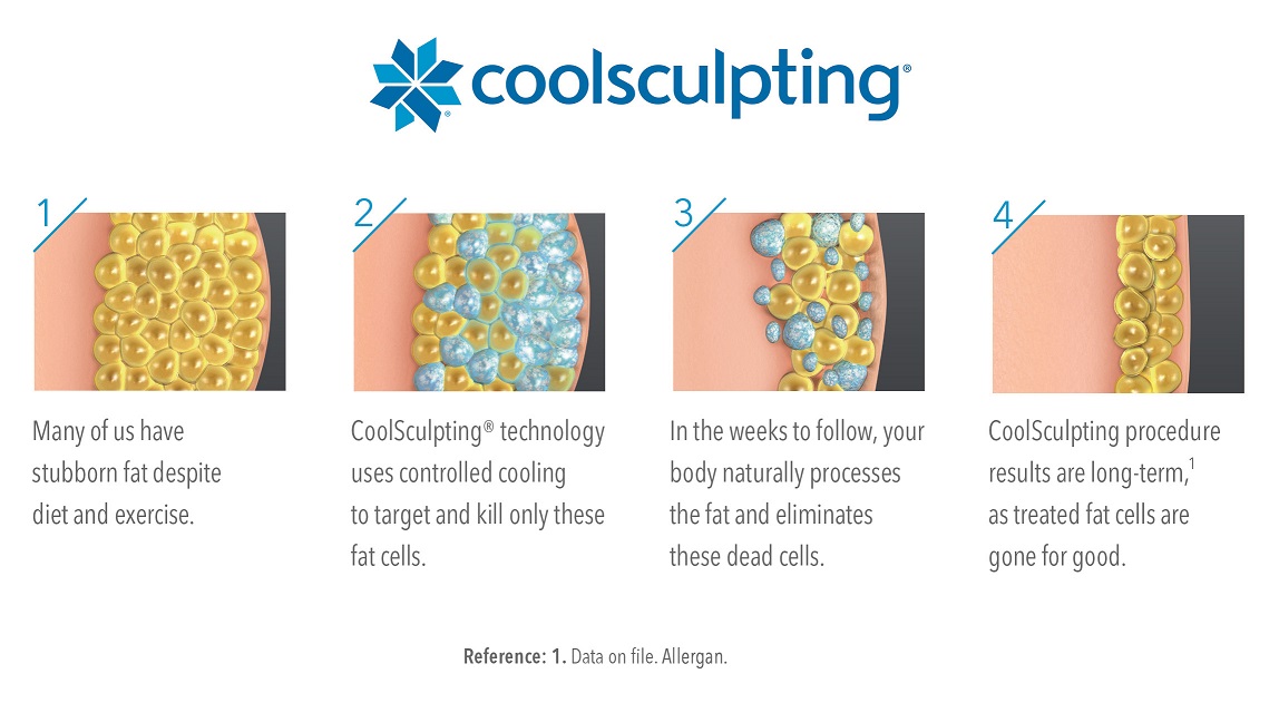 Coolsculpting Toronto Clinic Check Out Our Before Photos Dematology Centre