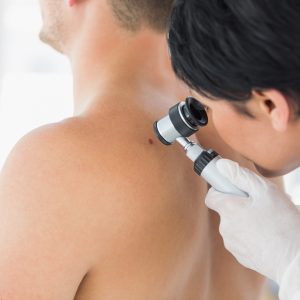 doctor examining mole on back of patient in clinic