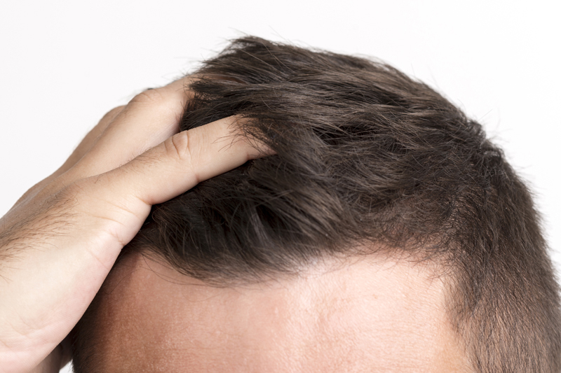 5 most effective ways to regrow thinning hair - Men's Journal - Toronto  Dermatology Centre