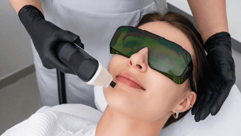 Excel V Laser Gensis Advanced Laser Treatments Toronto
