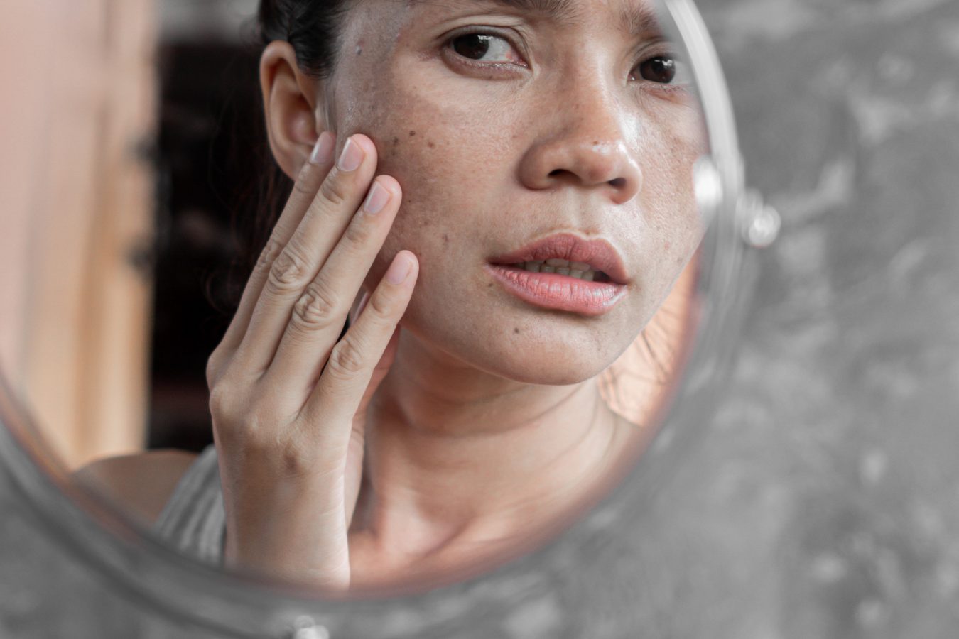 Asian woman checking face with dark spot melasma pigmentation in mirror