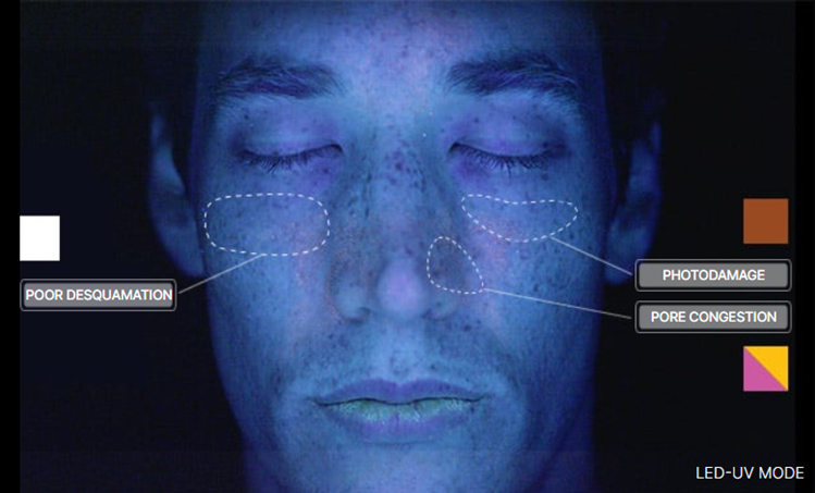 Facials | Skin Treatments - Toronto Dermatology Centre